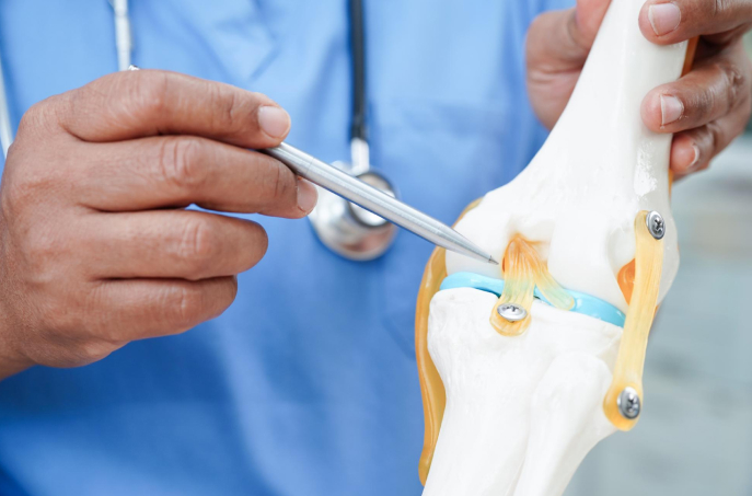 When Is Knee Replacement Considered?